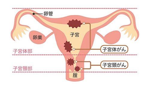 子宮画像
